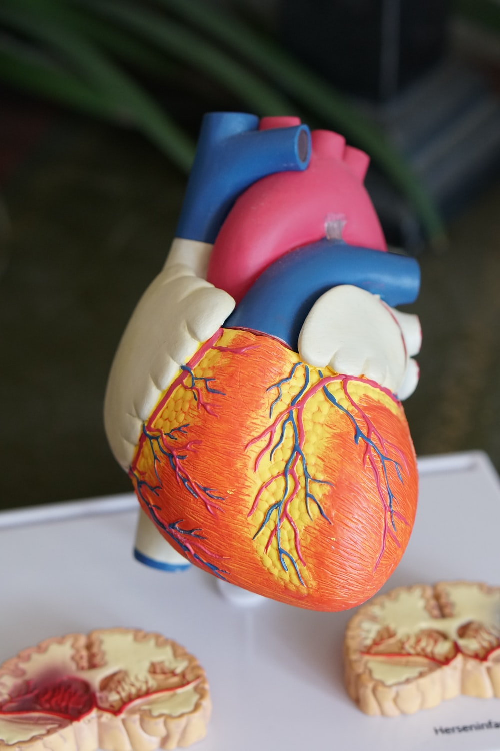 a model of a human heart