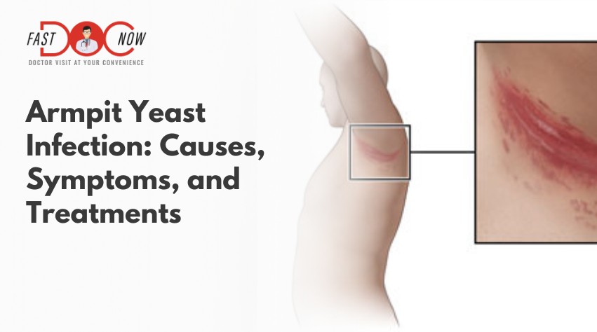 understanding-armpit-yeast-infection