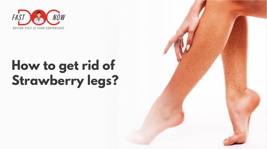How to Get rid of Strawberry Legs
