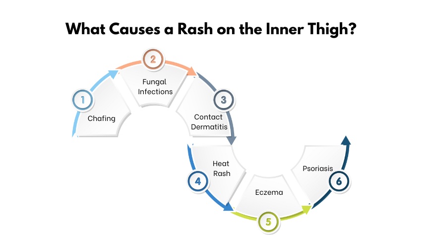 rash-on-inner-thigh