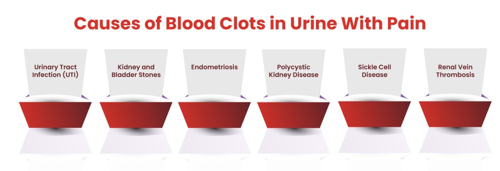 what-causes-small-blood-clots-in-urine