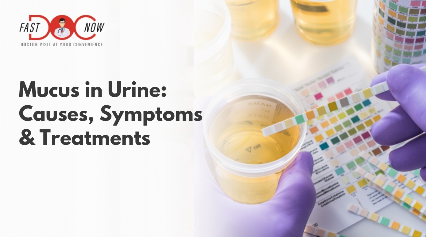 mucus-in-urine