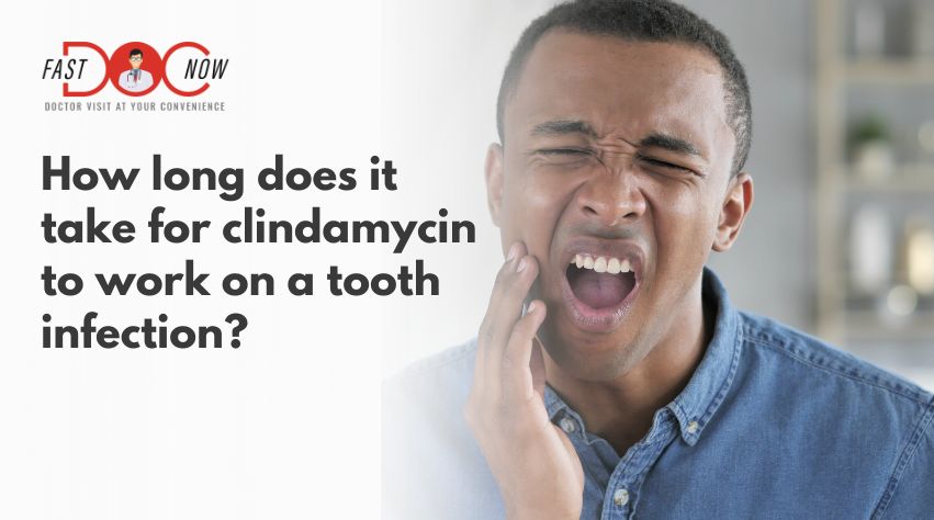 clindamycin-for-tooth-infections