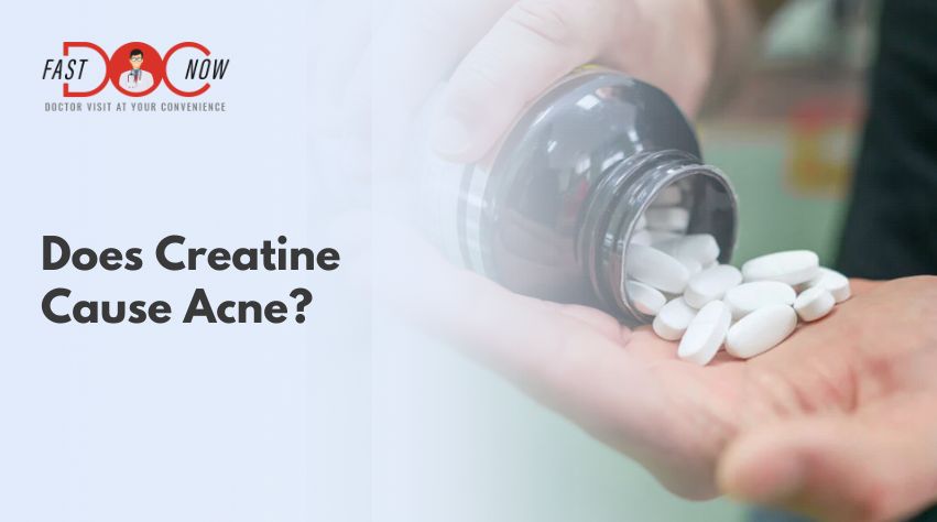 Does Creatine Cause Acne