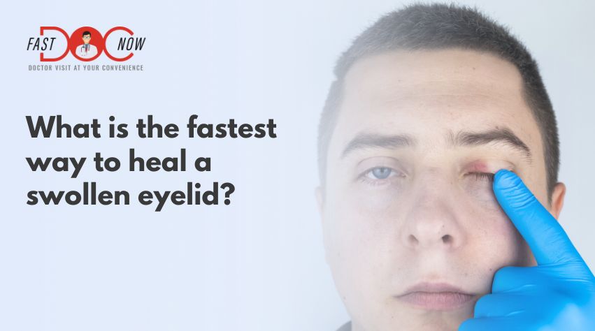 fastest-way-to-heal-swollen-eyelid